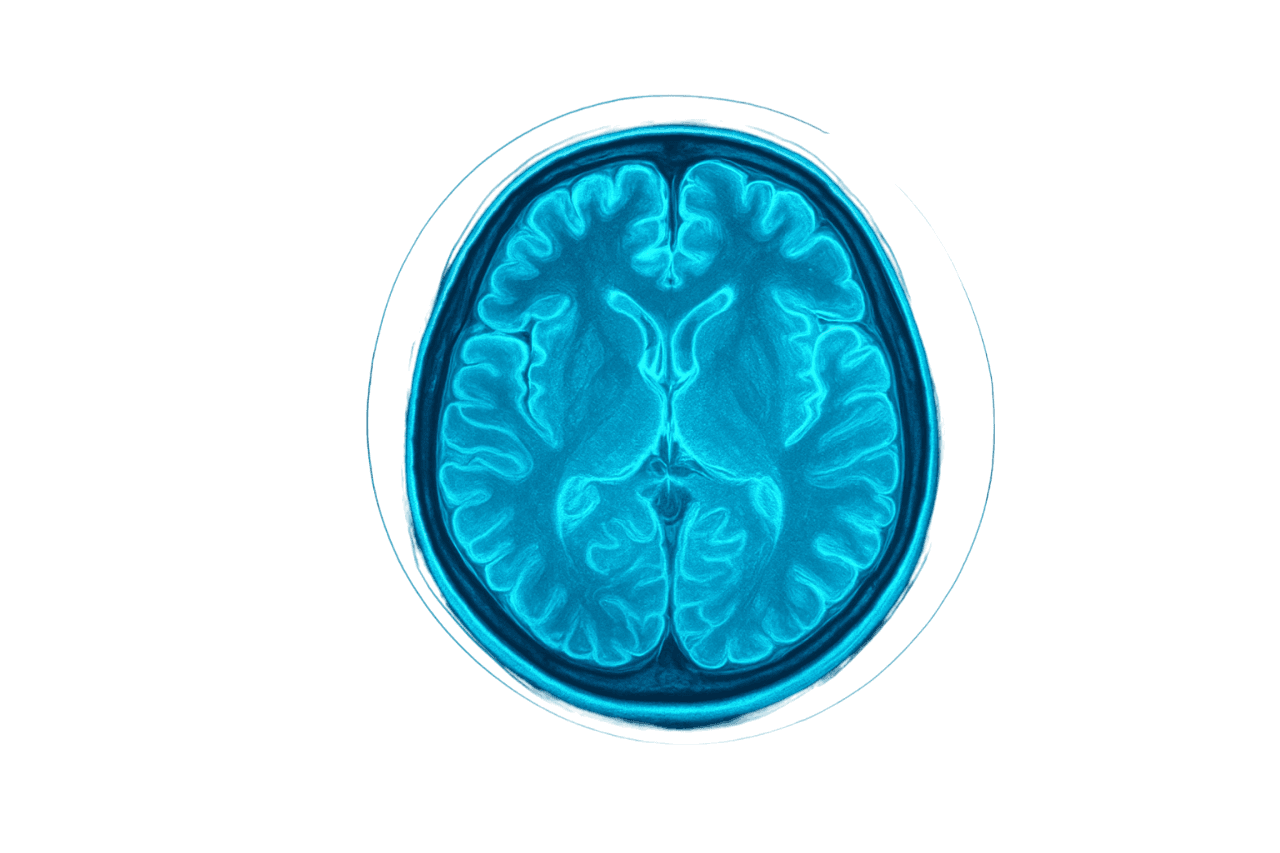 Brain MRI with highlighted tumor
